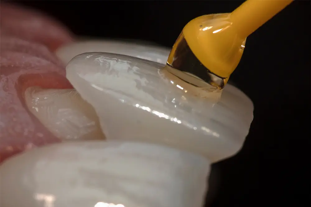 3d render of jaw with dental implant A dental veneer being applied to the tooth.