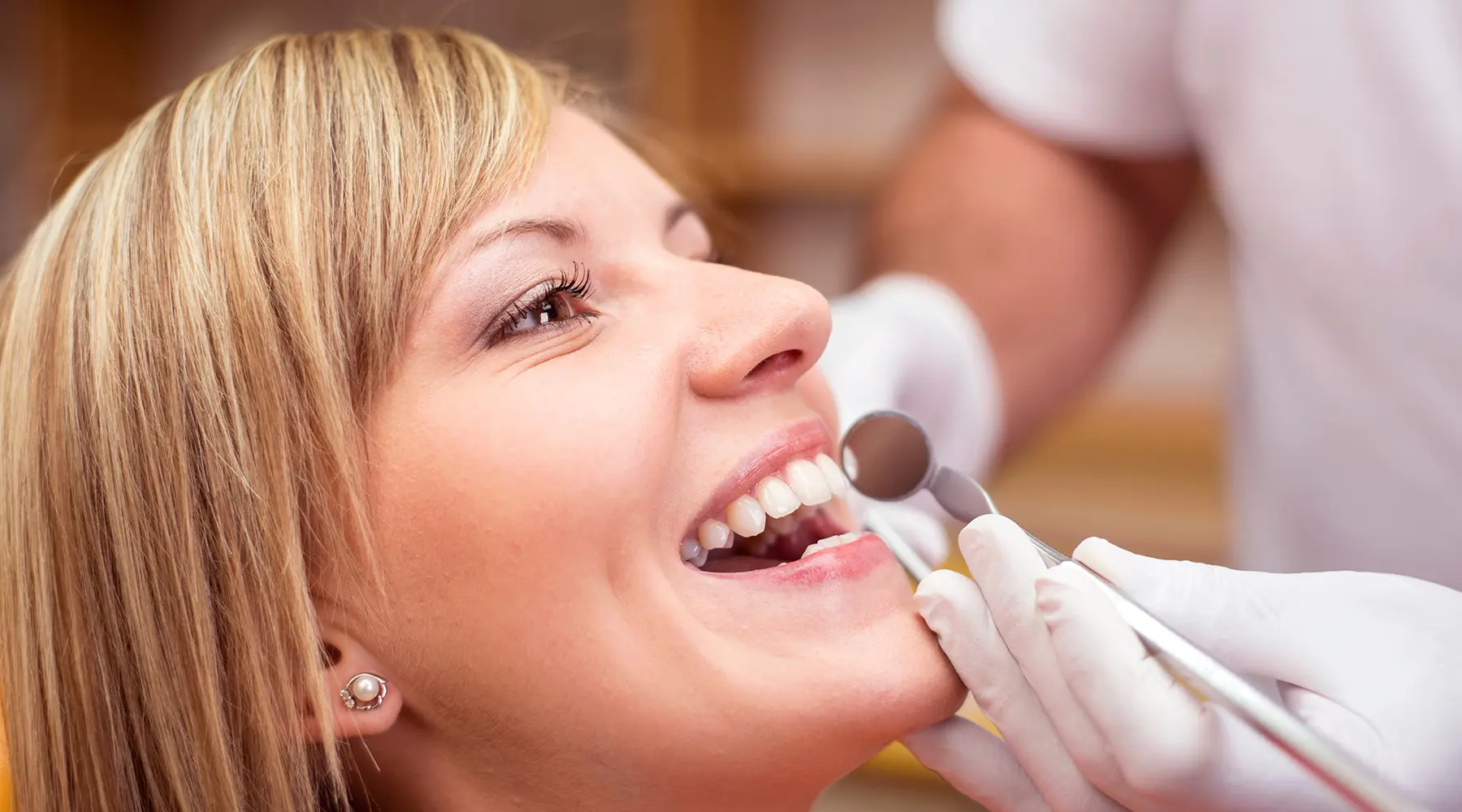 Can You Get Veneers If You Have Dental Fillings?