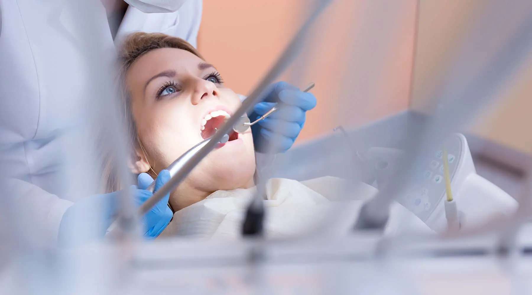 Root Canal Myths: What Patients Should Know