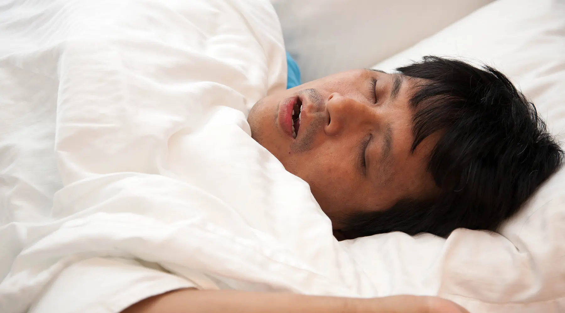 Oral Appliances for Sleep Apnea: Improving Health and Quality of Life