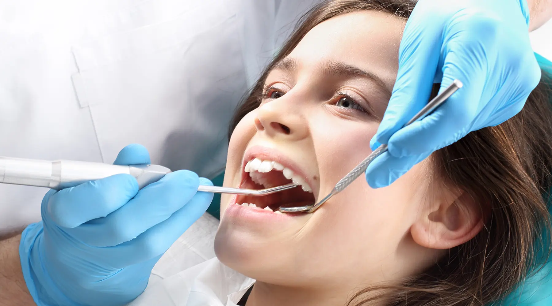 Dental Sealants: Protection Against Cavities for All Ages