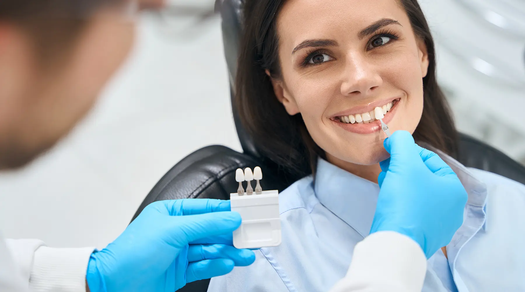 How Are Veneers Applied? Procedure Explained