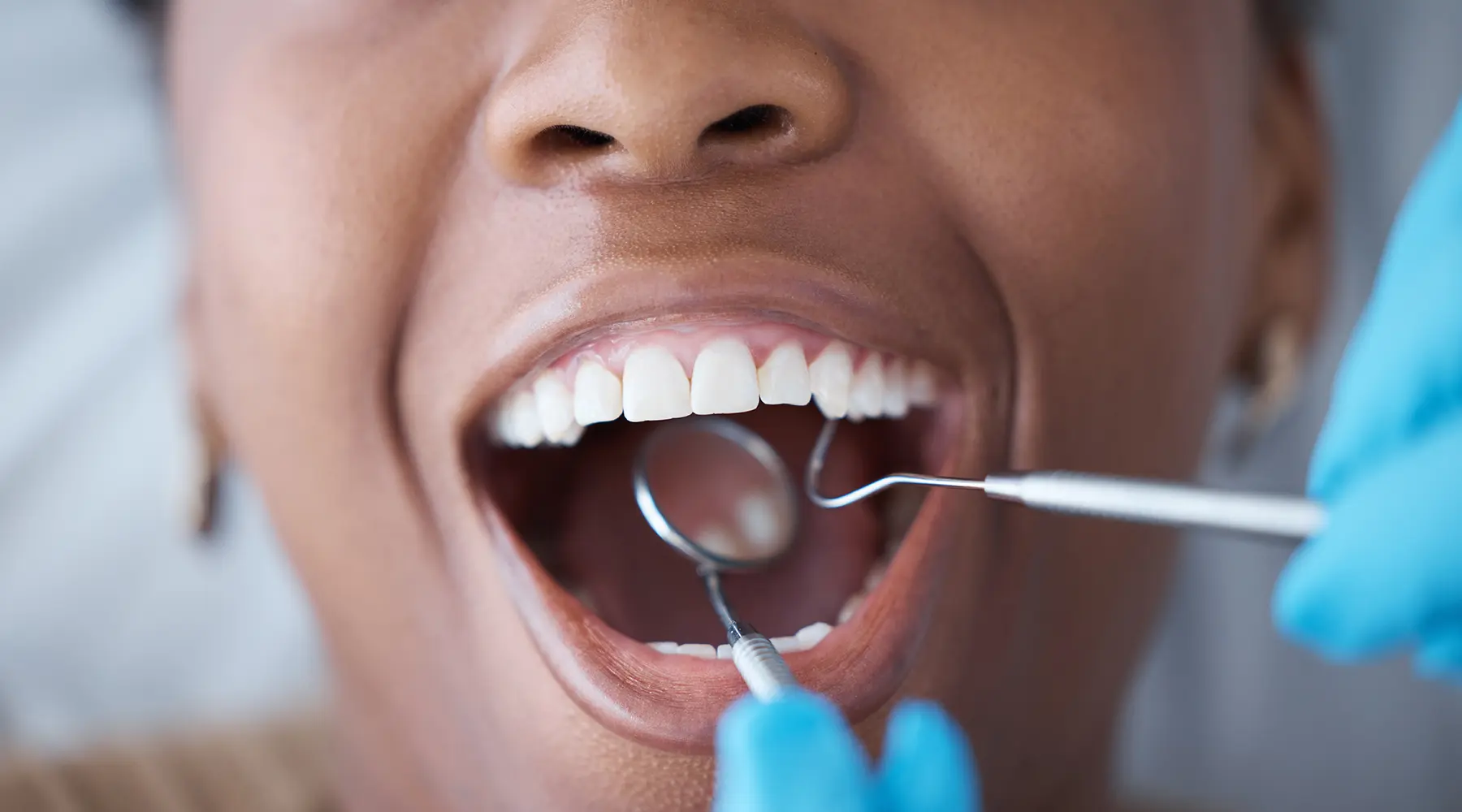 Can You Combine Teeth Whitening With a Dental Cleaning Appointment?